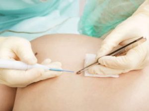 Patricia Abajo Blanco - Dermatología quirúrgica